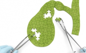 Sau phẫu thuật cắt túi mật, dùng TPBVSK Kim Đởm Khang được không?