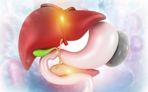 Bạn cần biết gì về polyp túi mật?