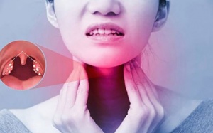 Viêm họng bao lâu thì khỏi?