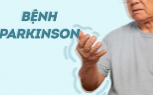 10 dấu hiệu cảnh báo sớm bệnh Parkinson
