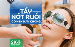 Podcast: Tẩy nốt ruồi có nên hay không?