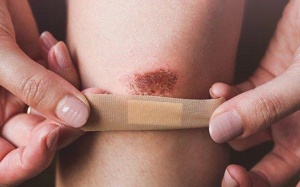 Dấu hiệu cảnh báo cơ thể bạn thiếu kẽm 