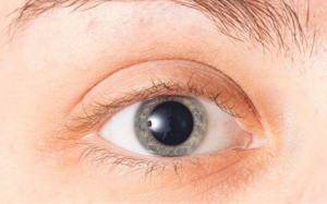 6 nguyên nhân gây giãn đồng tử 