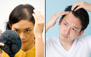 Hói đầu có đảo ngược được không?