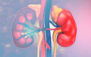 Ung thư thận: Xu hướng gia tăng đáng báo động
