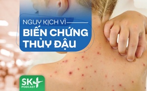 Podcast: Nguy kịch vì biến chứng thủy đậu