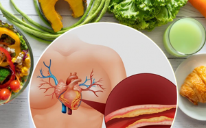 Mỡ máu cao có thể kiểm soát nhờ 4 thói quen lành mạnh