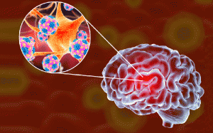 Bệnh não mô cầu xâm lấn: Tối ưu hóa dự phòng căn bệnh gây 'tử vong 24h'