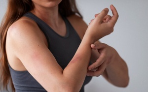 Mẹo xử lý phát ban da do quần áo ẩm ướt