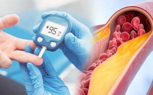 Tại sao người bệnh đái tháo đường hay bị xơ vữa động mạch?