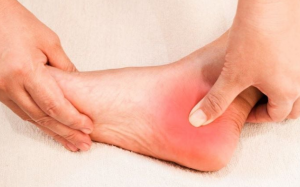 Những dấu hiệu bất thường ở chân không nên bỏ qua