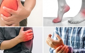 Bạn có biết ai dễ bị đau xương khớp?