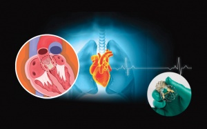 Có cách nào để trì hoãn thay van tim?