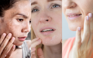 Nhận diện da thiếu ẩm qua 4 dấu hiệu cơ bản