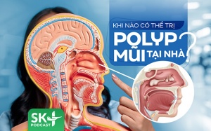 Podcast: Khi nào có thể trị polyp mũi tại nhà?