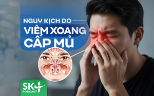 Podcast: Nguy kịch do viêm xoang cấp mủ
