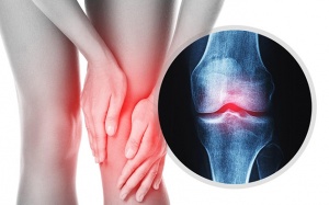 Đau xương khớp cảnh báo bệnh gì?