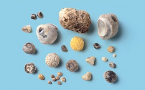 Sỏi mật 7mm: Dùng TPBVSK Kim Đởm Khang được không?