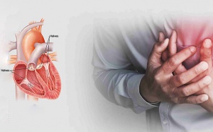 Hẹp van tim do thấp tim: Nguy cơ tiềm ẩn ở người trẻ