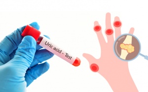 8 thói quen nhỏ giúp kiểm soát acid uric cao