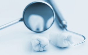 4 thói quen không nên làm trước buổi khám nha khoa