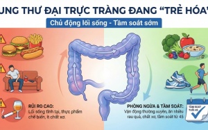 Khi nào người trẻ cần đi tầm soát ung thư đại trực tràng?