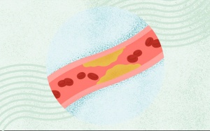 Bạn có thể mắc bệnh mạch vành dù không hề bị đau tức ngực?