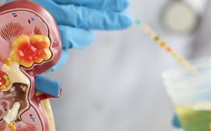 Bệnh thận mạn tính: Hiểu để dự phòng sớm!