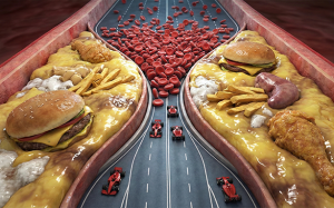 4 nhóm thực phẩm khiến cholesterol máu tăng vọt