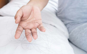 Vỏ gối và thói quen ngủ có liên quan đến rụng tóc?