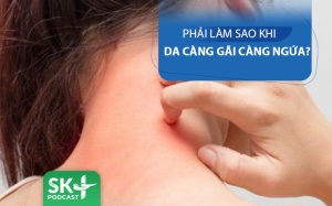 Podcast: Da bị ngứa càng gãi càng ngứa - Làm thế nào?