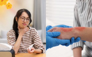 Infographic: Những bước sơ cứu cơ bản tại nhà ngày Tết