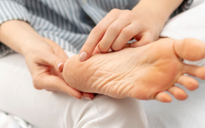 Cải thiện tình trạng nứt nẻ gót chân trong 4 bước