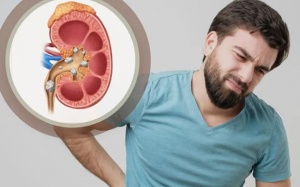 Vì sao nam giới dễ bị sỏi thận hơn nữ giới?
