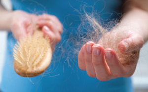 Nhận biết sớm dấu hiệu rụng tóc và cách hạn chế