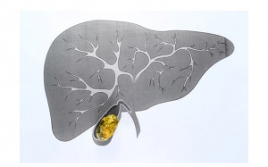 Cách tẩy sỏi gan 1 ngày có hiệu quả với sỏi 4,5mm không?