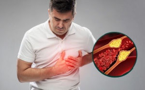 Lầm tưởng thường gặp về cholesterol
