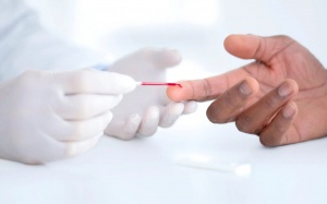 Hướng dẫn mới: Theo dõi chỉ số cholesterol từ khi còn trẻ