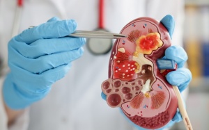 Sỏi thận có tự đào thải không?