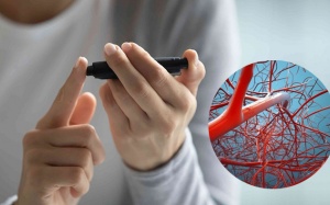 Mắc đái tháo đường: Cần biết gì về biến chứng mạch máu nhỏ của bệnh?