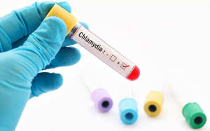 Điểm giống và khác giữa chlamyda và bệnh lậu là gì?