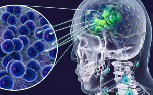 4 trường hợp tử vong do mắc viêm não mô cầu, Bộ Y tế phát cảnh báo