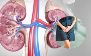 Thói quen chị em nên bỏ để bảo vệ đường tiết niệu