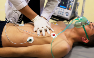 Sự thật về đột quỵ khi chơi thể thao