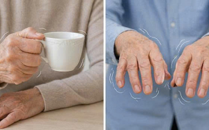 Cách phân biệt run do tuổi tác và run bệnh lý