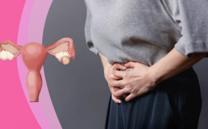 Giải pháp giúp kiểm soát u nang buồng trứng an toàn 