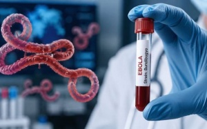 Biết gì về virus Bundibugyo có liên quan đến dịch Ebola?