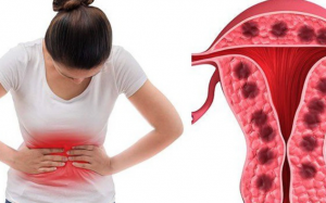 Một số bệnh phụ khoa có thể làm tăng nguy cơ bệnh tim và đột quỵ?