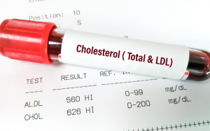 Ăn uống bình thường vẫn tăng cholesterol máu: Nguyên nhân từ đâu?