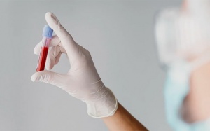 Tại sao đường huyết ổn định nhưng HbA1c vẫn cao?
